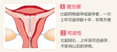 专家在线解答，上环取环的合适时间