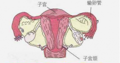 子宫性不孕症状有哪些？如何治？